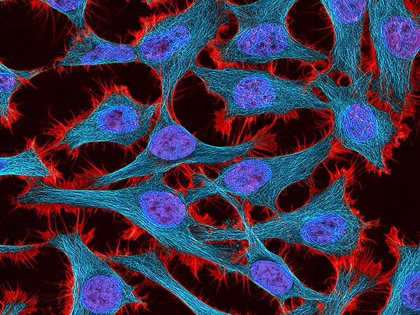 HeLa cells image